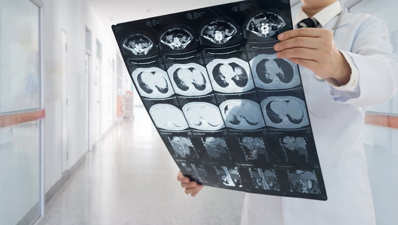 Tumore del fegato: gli antivirali per l&#8217;Hcv migliorano la sopravvivenza